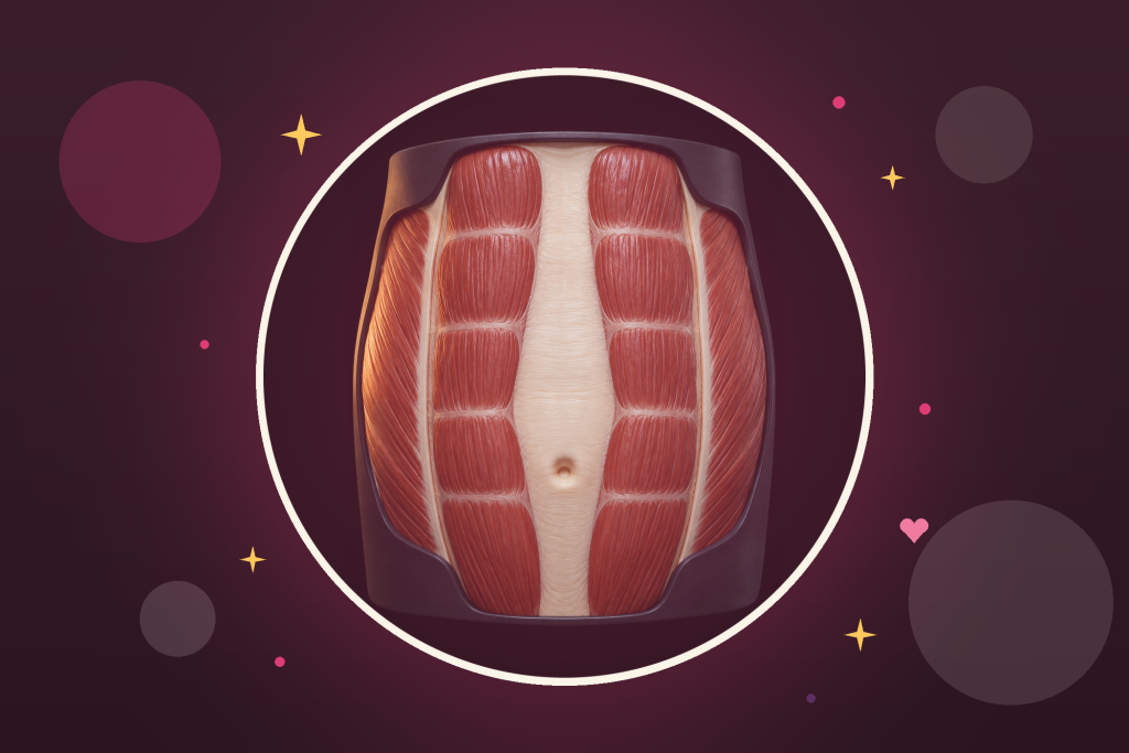 Diastasis : illustration réaliste des muscles grands droits écartés de part et d'autre de la ligne blanche
